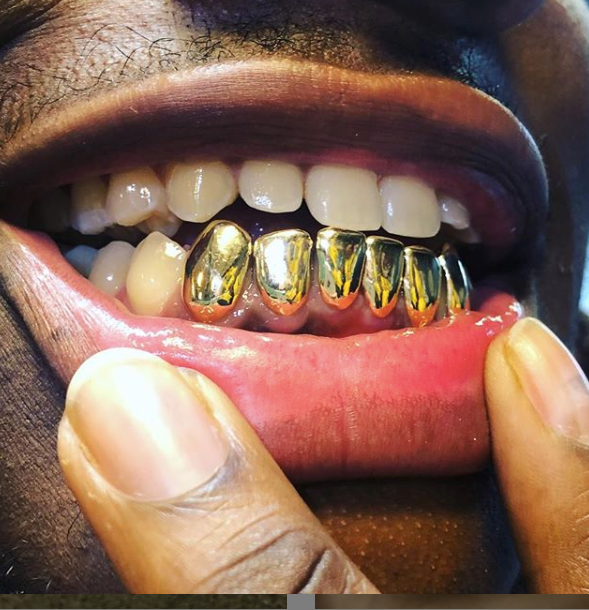 Permanent Style (Sold Per Tooth) - STL GRILLZZ