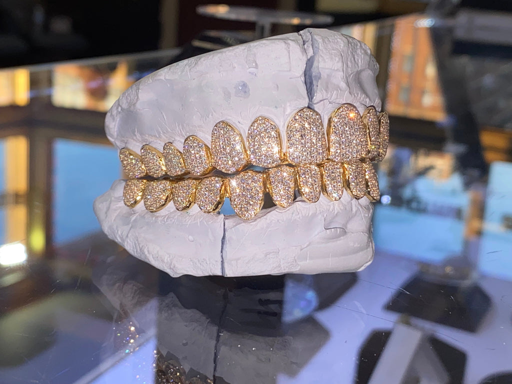 Buy Grillz Molding Kit - Real Gold and Diamond Teeth Online – Luxe