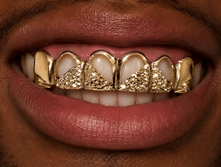 Gold Arch-Cut Diamond Texture Grillz